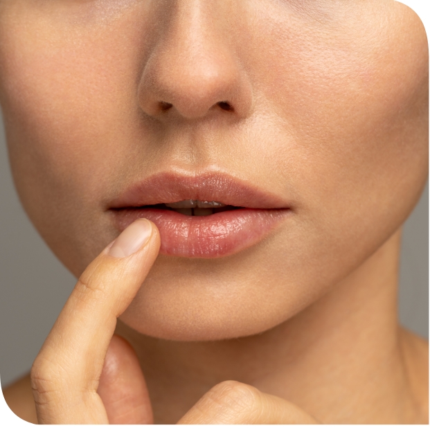 Labbra Secche e Screpolate